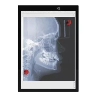 Negatoscópio Led Médico Grande A3 Chapa Radiografia Portátil