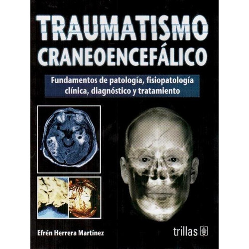 Traumatismo Craneoencefálico: Fundamentos De Patología, Fis