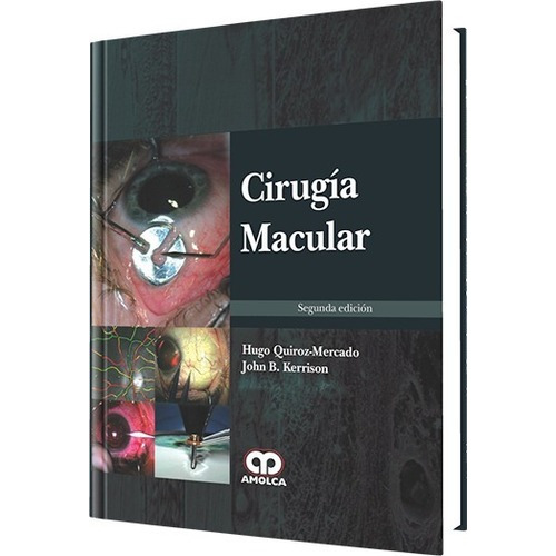 Cirugía Macular Segunda Edición Quiroz Mercado