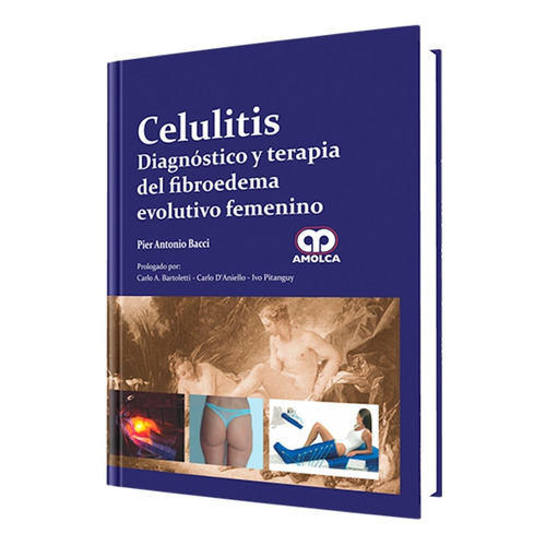 Celulitis Diagnóstico Y Terapia Del Fibroedema Evolutivo Fem