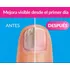 Serum Antihongos Para Uñas - Cura Manos Y Pies 100 Ml Neutra