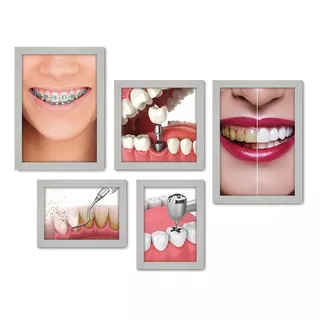 Kit Com 5 Quadros Decorativos - Dentista Consultório 185 Cor Moldura Branca