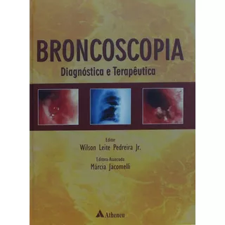 Broncoscopia Diagnóstico E Terapêutica, De Pedreira Jr., Wilson Leite. Editora Atheneu Ltda, Capa Mole Em Português, 2005