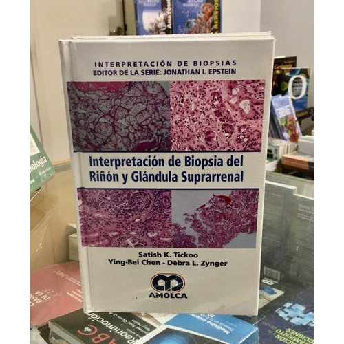 Interpretación De Biopsia Del Riñón Y Glándula Supra, De Satish K. Tickoo. Editorial Amolca En Español