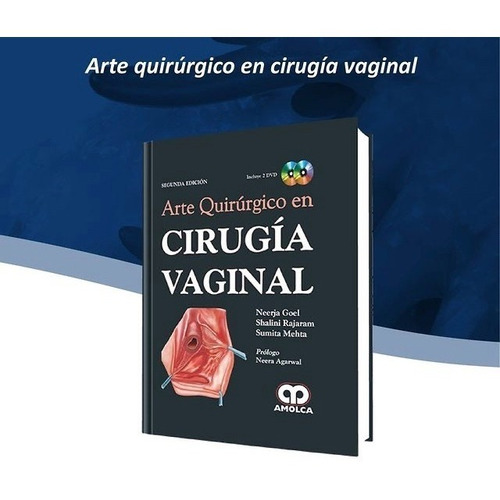 Arte Quirúrgico En Cirugía Vaginal 2 Ed Goel