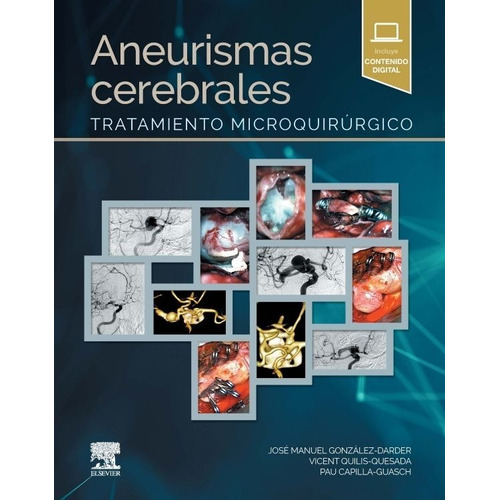 Aneurismas Cerebrales Tratamiento Microquirúrgico Gonzalez-d