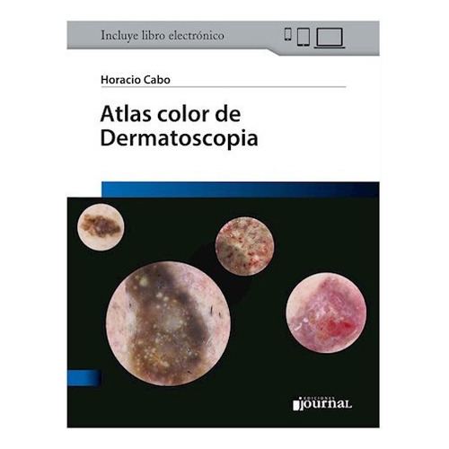 Atlas Color De Dermatoscopia Horacio Cabo Journal