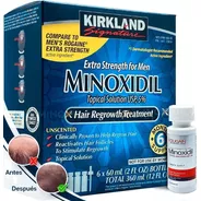 7 Meses De Minoxidil 5% Tópico | Sellados | 100% Originales