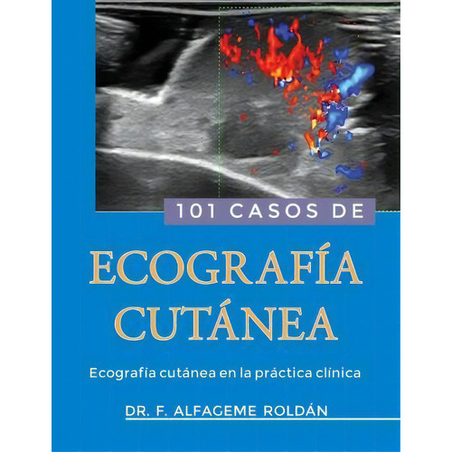 101 Casos De Ecografia Cutanea, De Dr Fernando Alfageme Roldan. Editorial Createspace Independent Publishing Platform, Tapa Blanda En Español