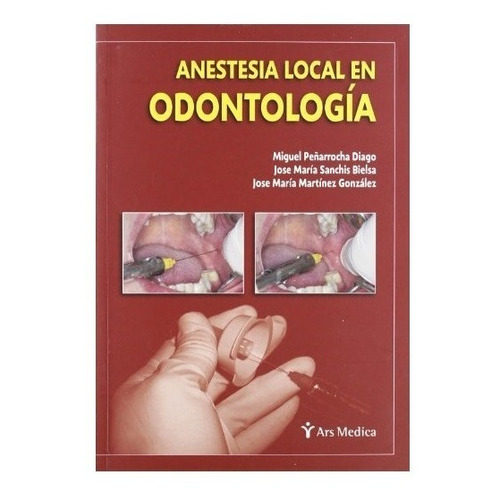 Anestesia Local En Odontología Peñarrocha Ars Medica