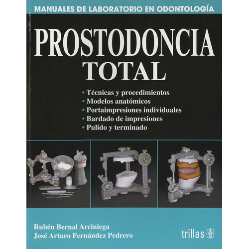 Prostodoncia Total