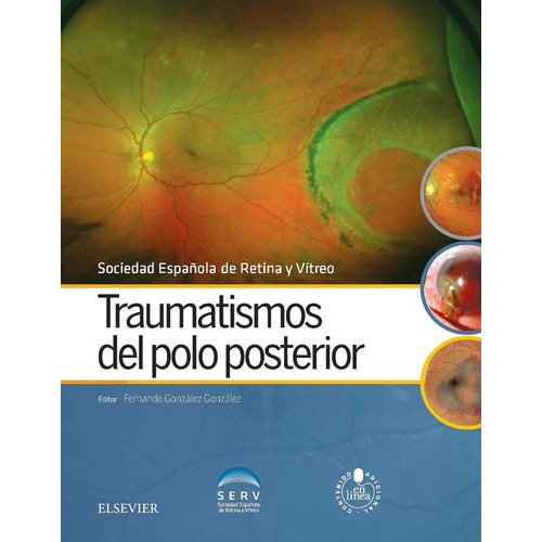 Traumatismos Del Polo Posterior + Acceso Online Serv 