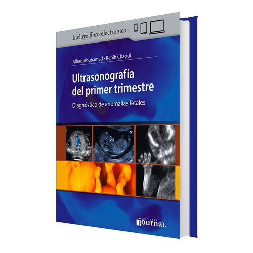 Abuhamad Chaoui Anomalías Fetales Ultrasonografía 1er Trimes
