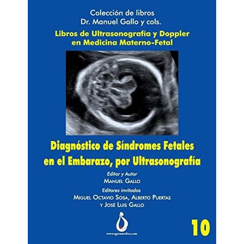Diagnostico De Sindromes Fetales En El Embarazo, Por Ultrasonografia, De Manuel Gallo. Editorial Independently Published, Tapa Blanda En Español