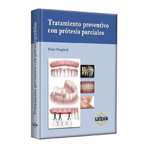 Pospiech Tratamiento Preventico Con Protesis Parciales