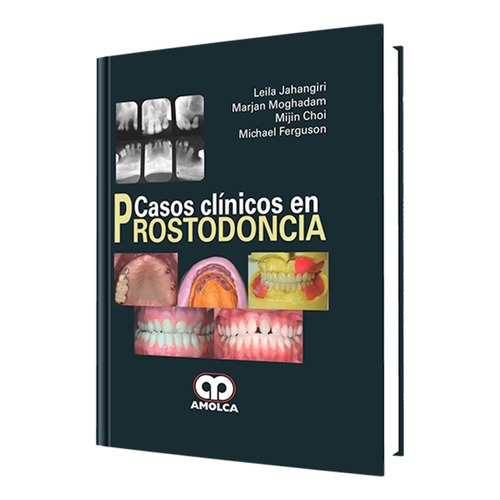 Casos Clínicos En Prostodoncia.  El Libro De Rehabilitación 