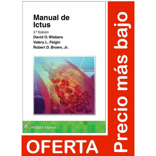 Manual De Ictus, De David O. Wiebers. Editorial Wolters Kluwer, Tapa Blanda En Español, 2022