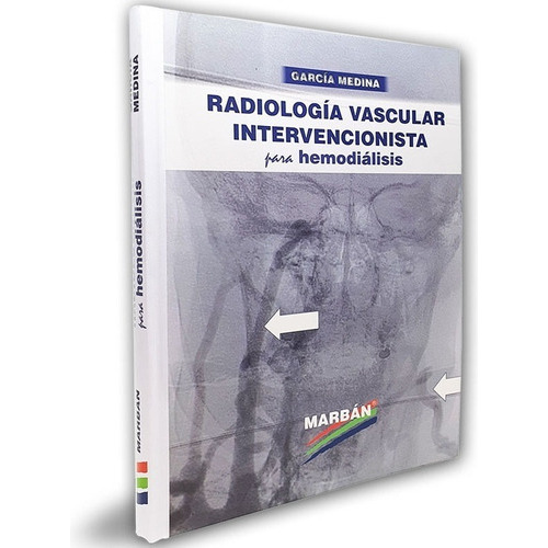 Radiología Vascular Intervencionista Para Hemodiálisis: No Aplica, De Garcia Medina. Serie No Aplica, Vol. No Aplica. Editorial Marban, Tapa Dura, Edición 1 En Español, 2021