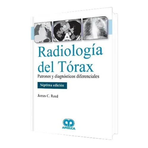 Radiología Del Tórax Patrones Y Diagnósticos Diferenc. 7 Ed