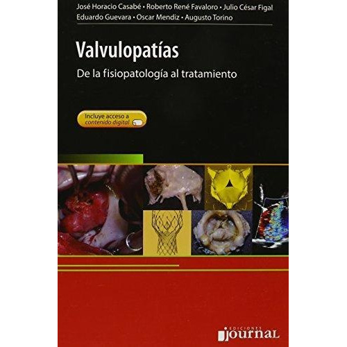 Valvulopatias. De La Fisiopatologia Al Tratamiento