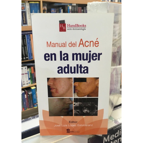 Manual Del Acné En La Mujer Adulta, De José Luis López Estebaranz. Editorial Aula Médica, Tapa Blanda En Español, 2016