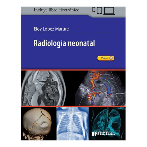 Radiología Neonatal  Ediciones Journal López Marure