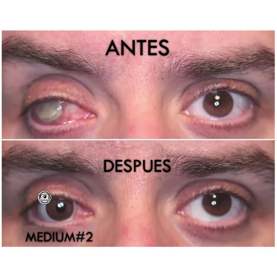 Pupilentes Lente De Contacto Pupila Negra Iris Medium 14.2mm