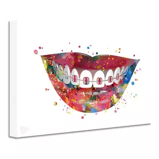 Cuadro Dentista Artístico Odontología Canvas  60x40 Dah2