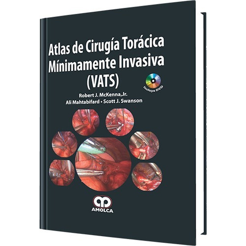 Atlas De Cirugía Torácica Mínimamente Invasiva Vats