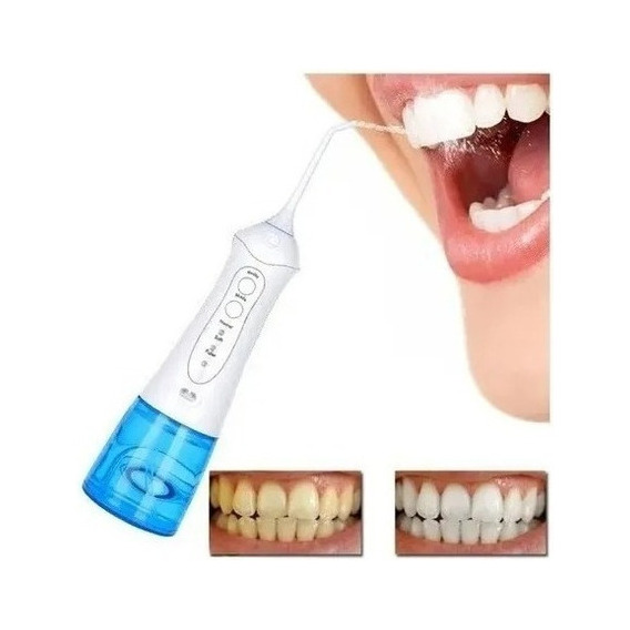 Limpiador Enjuagues Bucal Irrigador Dental Portatil/5037 Color Blanco