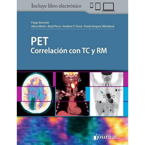 Pet Correlación Con Tc Y Rm