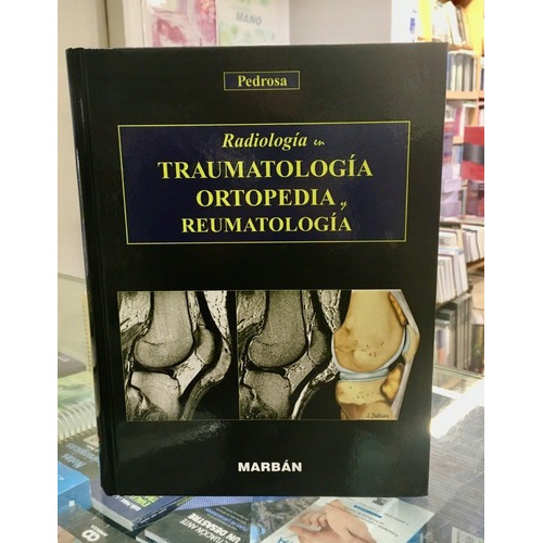 Pedrosa Radiología En Traumatología Ortopedia Y Reum, De Pedrosa Cesar. Editorial Marb{an En Español