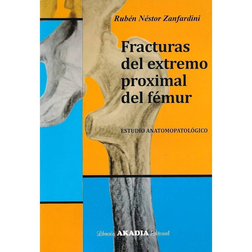 Fracturas Del Extremo Proximal Del Femur, De Zanfardini. Libreria Akadia Editorial, Tapa Blanda En Español, 2015