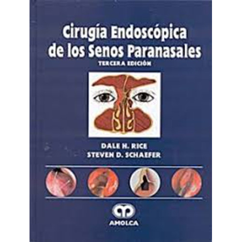 Cirugia Endoscopica De Los Senos Paranasales - Dale Rice