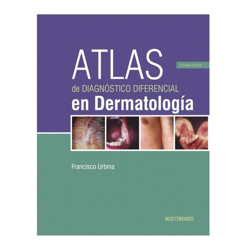Atlas De Diagnóstico Diferencial En Dermatología 3 Ed Urbina