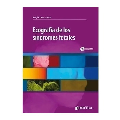 Ecografía De Los Síndromes Fetales Benacerraf !