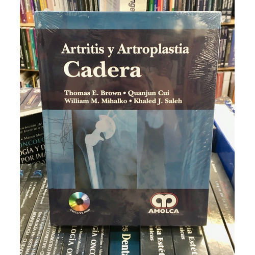 Artritis Y Artroplastia Cadera