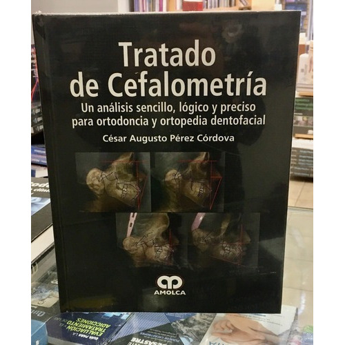 Tratado De Cefalometría, de CESAR A. PÉREZ CÓRDOVA. Editorial Amolca en español