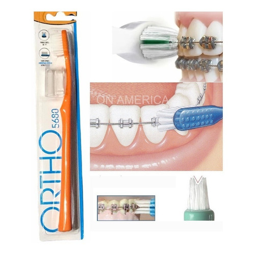 Cepillo Dental Para Ortodoncia Corte En V Suave Celeste