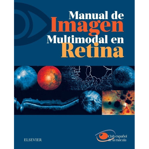 Manual De Imagen Multimodal En Retina, De Club Español De La Mácula. Editorial Elsevier, Tapa Blanda En Español, 2017