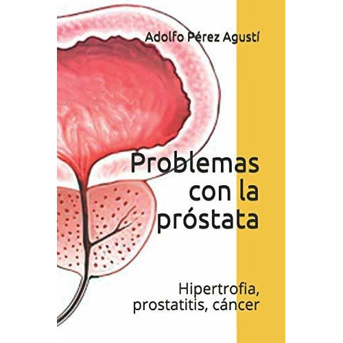 Problemas Con La Prostata : Hipertrofia, Prostatitis, Cancer, De Adolfo Perez Agusti. Editorial Independently Published, Tapa Blanda En Español
