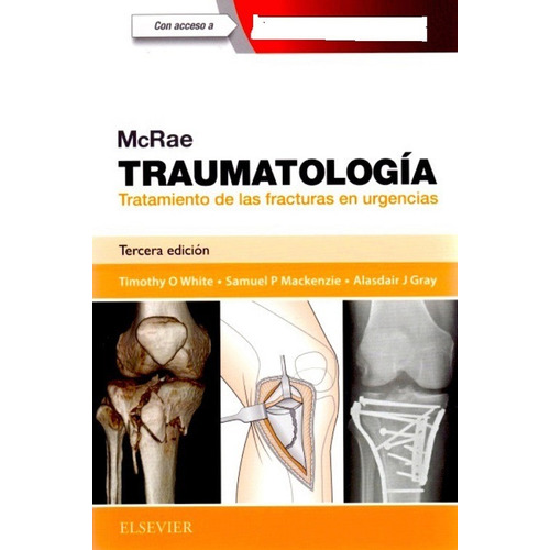 Traumatología Tratamiento De Las Fracturas En Urgencias 3era Edición, De White O. Timothy. Editorial Elsevier, Tapa Blanda En Español, 2017