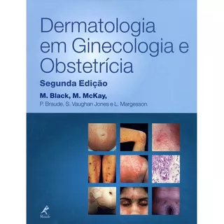 Dermatologia Em Ginecologia E Obstetrícia, De Black, M. Editora Manole Ltda, Capa Dura Em Português, 2002