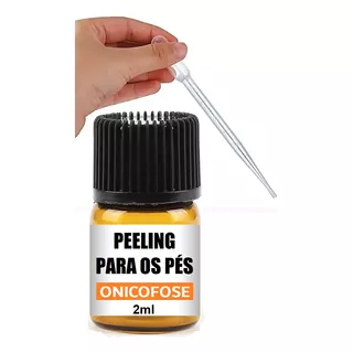 Peeling Químico Podologia 2ml Retirar Calosidade, Onicofose 
