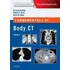 Fundamentals Of Body Ct - W.richard Webb