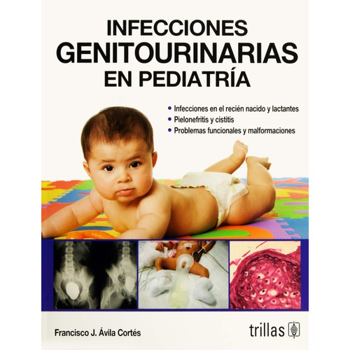 Infecciones Genitourinarias En Pediatría Trillas