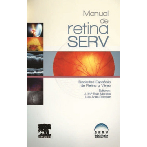 Manual De Retina Serv, De Serv. Editorial Elsevier En Español