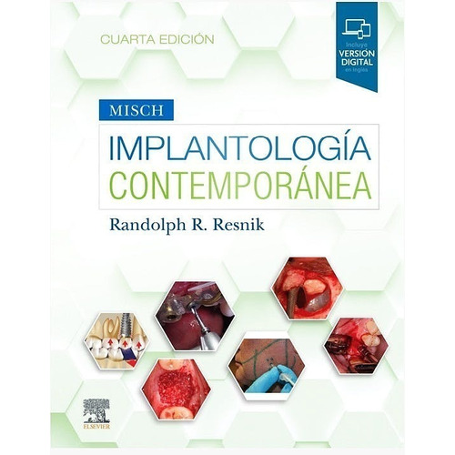 Implantología Contemporánea Misch + Versión Digital Inglés