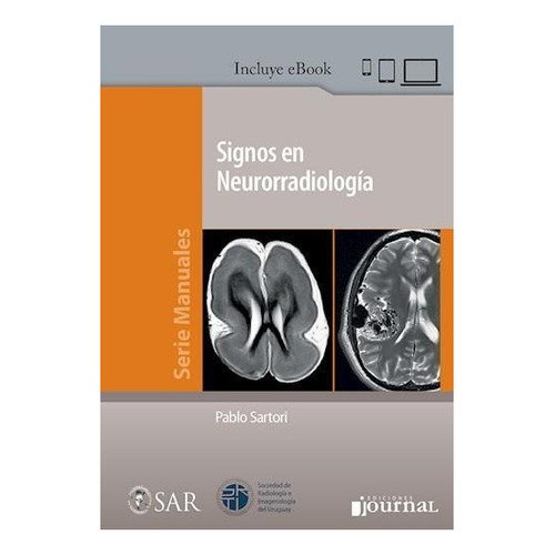 Signos En Neurorradiologia