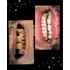 Carilla Dental En Resina (precio Por Unidad)